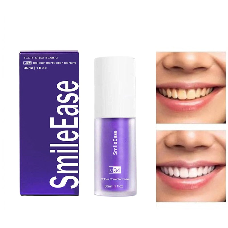 Teeth Whitening Toothpaste | Teeth Brightening | Smile Ease