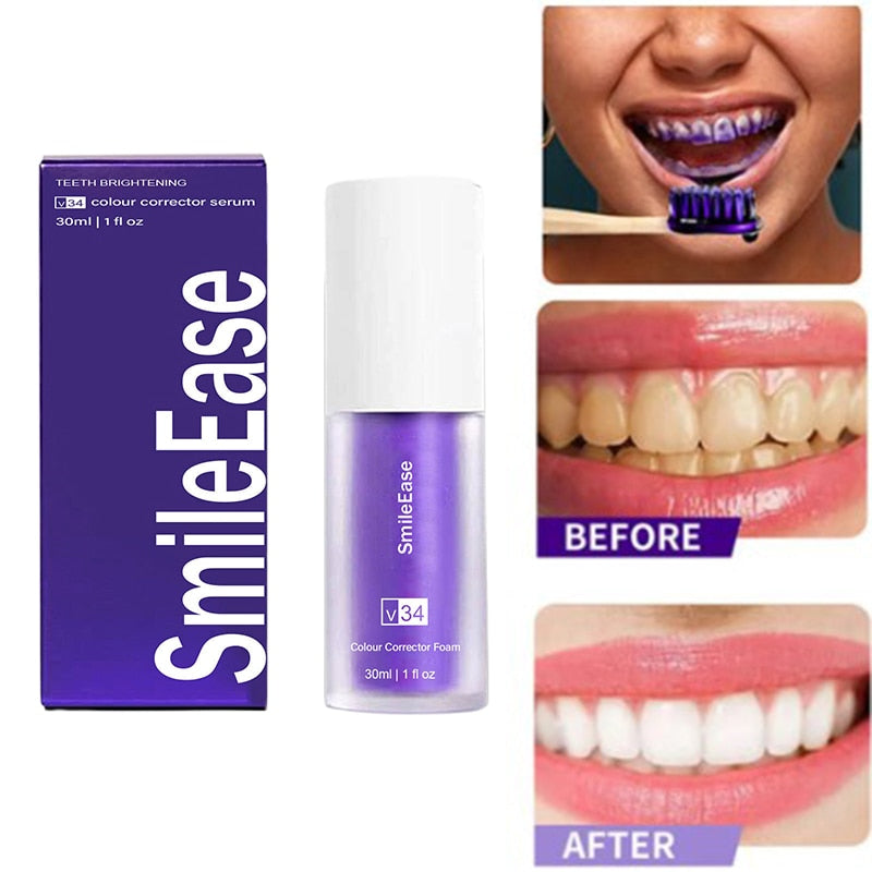 Teeth Whitening Toothpaste | Teeth Brightening | Smile Ease